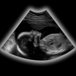 Baby Measures icon