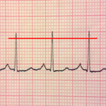 ECG Reader2 free for pc icon