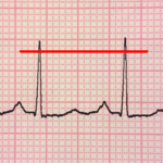 ECG Reader free icon