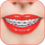 Braces 2018 icon