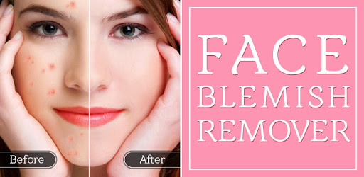 Face Blemish Remover - Smooth Skin & Beautify Face pc screenshot Face Blemish Remover - Smooth Skin & Beautify Face pc screenshot