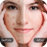 Face Blemish Remover - Smooth Skin & Beautify Face icon