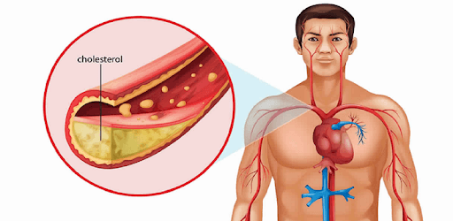 Top Foods That Lowers Cholesterol pc screenshot Top Foods That Lowers Cholesterol pc screenshot