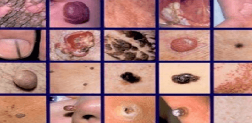 Clinical Dermatology (Colored & Illustrated Atlas) pc screenshot Clinical Dermatology (Colored & Illustrated Atlas) pc screenshot