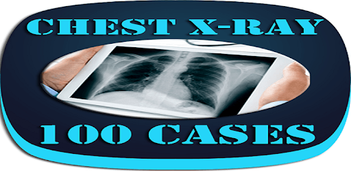 Interpret Chest X-Ray With 100 Cases pc screenshot Interpret Chest X-Ray With 100 Cases pc screenshot