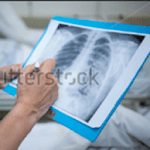 Chest X-Ray Based Cases icon