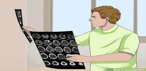 CT Brain Interpretation pc screenshot CT Brain Interpretation pc screenshot