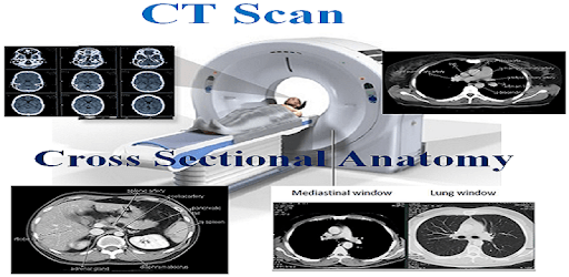 CT Scan Cross Sectional Anatomy pc screenshot CT Scan Cross Sectional Anatomy pc screenshot