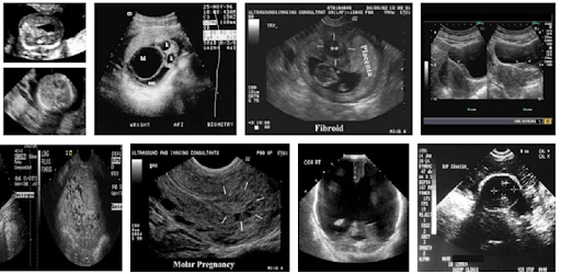 100 Cases in Obstetrics and Gynaecology pc screenshot