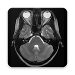 POCKET ATLAS MRI icon