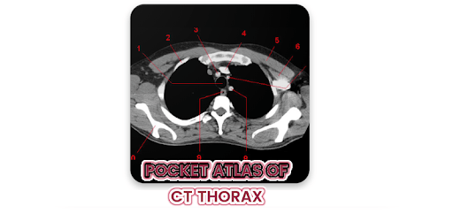POCKET ATLAS CT THORAX pc screenshot POCKET ATLAS CT THORAX pc screenshot
