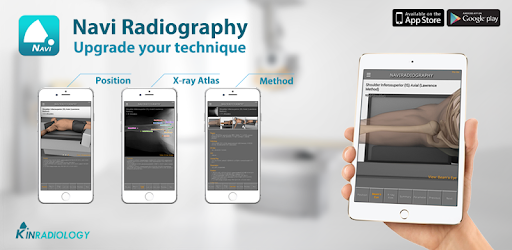 Navi Radiography Lite pc screenshot Navi Radiography Lite pc screenshot