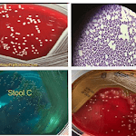 Microbiology quiz; plate reading app. icon