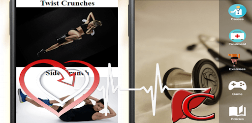 Urinary Tract Infection UTI - Treatment & Causes pc screenshot Urinary Tract Infection UTI - Treatment & Causes pc screenshot
