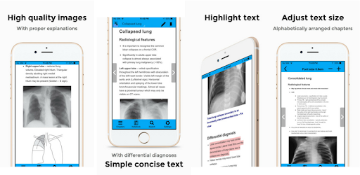 CXR FlashCards - Reference app for Chest X-rays pc screenshot CXR FlashCards - Reference app for Chest X-rays pc screenshot