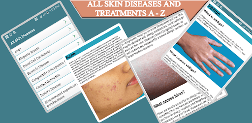 All Skin Diseases and Treatment- A to Z pc screenshot All Skin Diseases and Treatment- A to Z pc screenshot