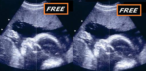 Pregnancy Baby & Baby Kick pc screenshot