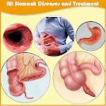 All stomach diseases and treatment icon