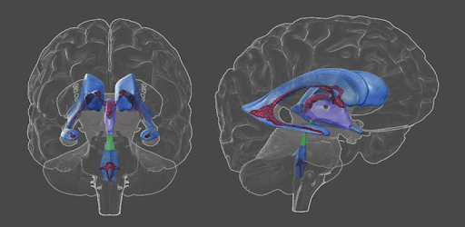 3D Brain pc screenshot 3D Brain pc screenshot